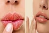 শীত পড়ার আগেই ঠোঁট ফেটে যাচ্ছে? নরম গোলাপি ঠোঁট পেতে জেনে নিন ঘরোয়া সহজ উপায়