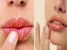 শীত পড়ার আগেই ঠোঁট ফেটে যাচ্ছে? নরম গোলাপি ঠোঁট পেতে জেনে নিন ঘরোয়া সহজ উপায়