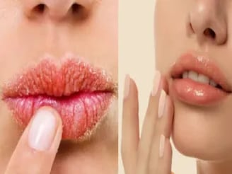 শীত পড়ার আগেই ঠোঁট ফেটে যাচ্ছে? নরম গোলাপি ঠোঁট পেতে জেনে নিন ঘরোয়া সহজ উপায়