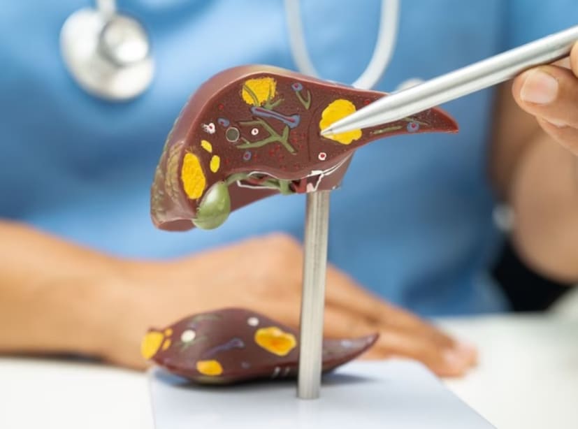 অভিনবের মৃত্যু হয়েছে লিভার সিরোসিসে৷ লিভার সিরোসিসের প্রধান কারণগুলি কী? লিভার সিরোসিসের চিকিৎসা এবং এই রোগ প্রতিরোধ করা সম্ভব কিনা সে সম্পর্কে কী জানা গিয়েছে।