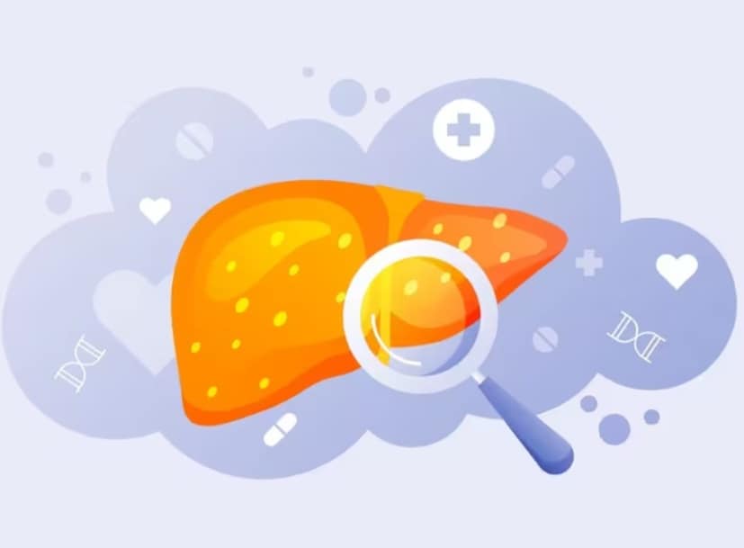 এটি কি প্রতিরোধ করা যেতে পারে? প্রতিরোধমূলক ব্যবস্থার মধ্যে রয়েছে সুষম খাদ্য গ্রহণ, স্বাস্থ্যকর ওজন বজায় রাখা, অ্যালকোহল/মাদকদ্রব্য এড়িয়ে চলা এবং হেপাটাইটিস টিকা দেওয়ার মাধ্যমে রোগে আক্রান্ত হওয়ার ঝুঁকি হ্রাস করা।