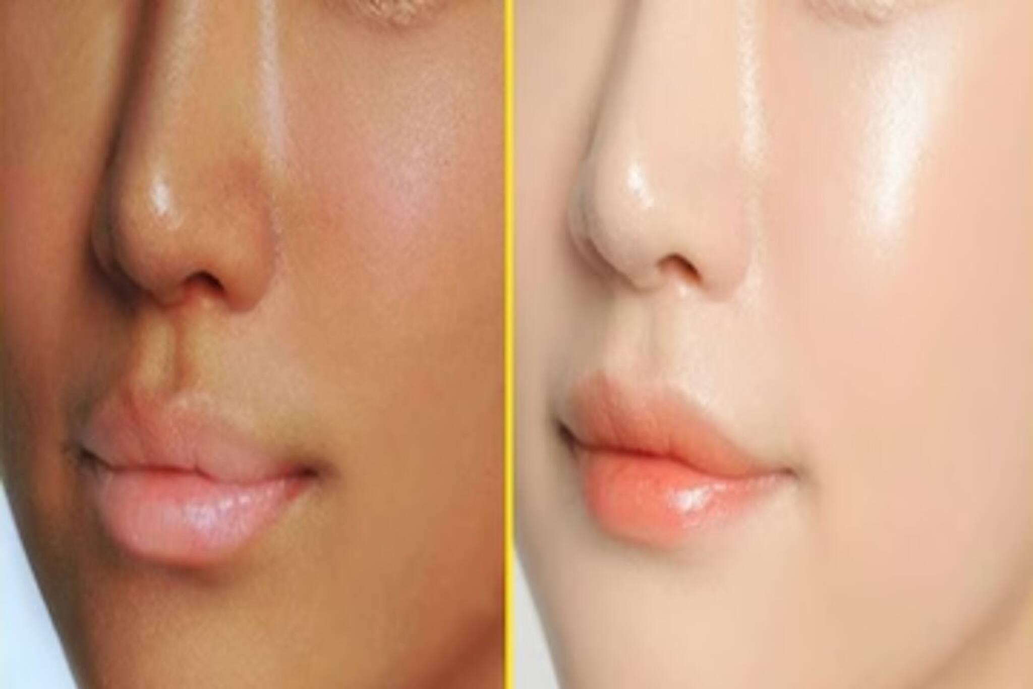 সোনার মতো চকচক করবে মুখ...! রাতে ঘুমোনোর আগে গ্লিসারিনে দুই ঘরোয়া জিনিস মিশিয়ে মাখুন