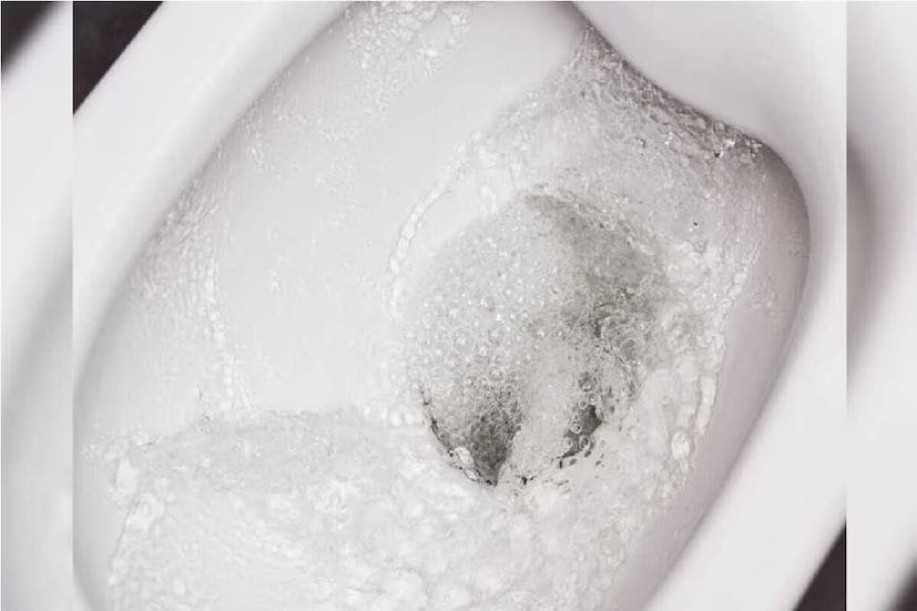 গরম জল: টয়লেটের ড্রেন পরিষ্কার করার জন্য, পাইপে গরম জল ঢালুন। দুটি ধাপে জল ঢালতে ভুলবেন না। প্রথমবার গরম জল ঢালার পর, কিছুক্ষণ রেখে দিন। এতে ভিতরে থাকা ময়লা কিছুটা তাপে দ্রবীভূত হবে। তারপর পাইপটির নজলের মধ্য দিয়ে সবটা ময়লা বেরিয়ে যাবে। তারপর দ্বিতীয়বার জল ঢেলে দিলেই পাইপ দু'মিনিটে পরিষ্কার।