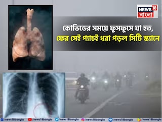 করোনার সময়ের মতো ভয়ানক দাগ ফুসফুসে করোনার সময়ের মতো ভয়ানক দাগ ফুসফুসে