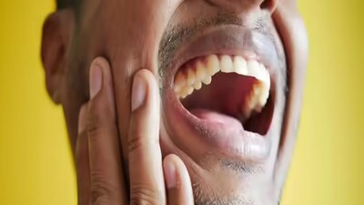 টি ব্যাগ-- টি ব্যাগ ব্যবহার করতে পারেন। এর অ্যান্টিব্যাকটেরিয়াল, অ্যান্টিইনফ্লামেশন গুণ রয়েছে। ফলে ব্যাকটেরিয়া মরে যায়। এমনকী মাড়ির ফোলাও কমে। পেঁয়াজ খেতে পারেন-- দেখা গিয়েছে পেঁয়াজে রয়েছে অনেকটা পরিমাণে অ্যান্টিইনফ্লেমেটরি ও অ্যান্টিমাইক্রোবিয়াল গুণ। এই কারণে ব্যাকটেরিয়ার বিরুদ্ধে সহজেই লড়াই জেতা যায়। তাই পেঁয়াজও আক্কেল দাঁতের ব্যথা কমাতে সিদ্ধহস্ত।