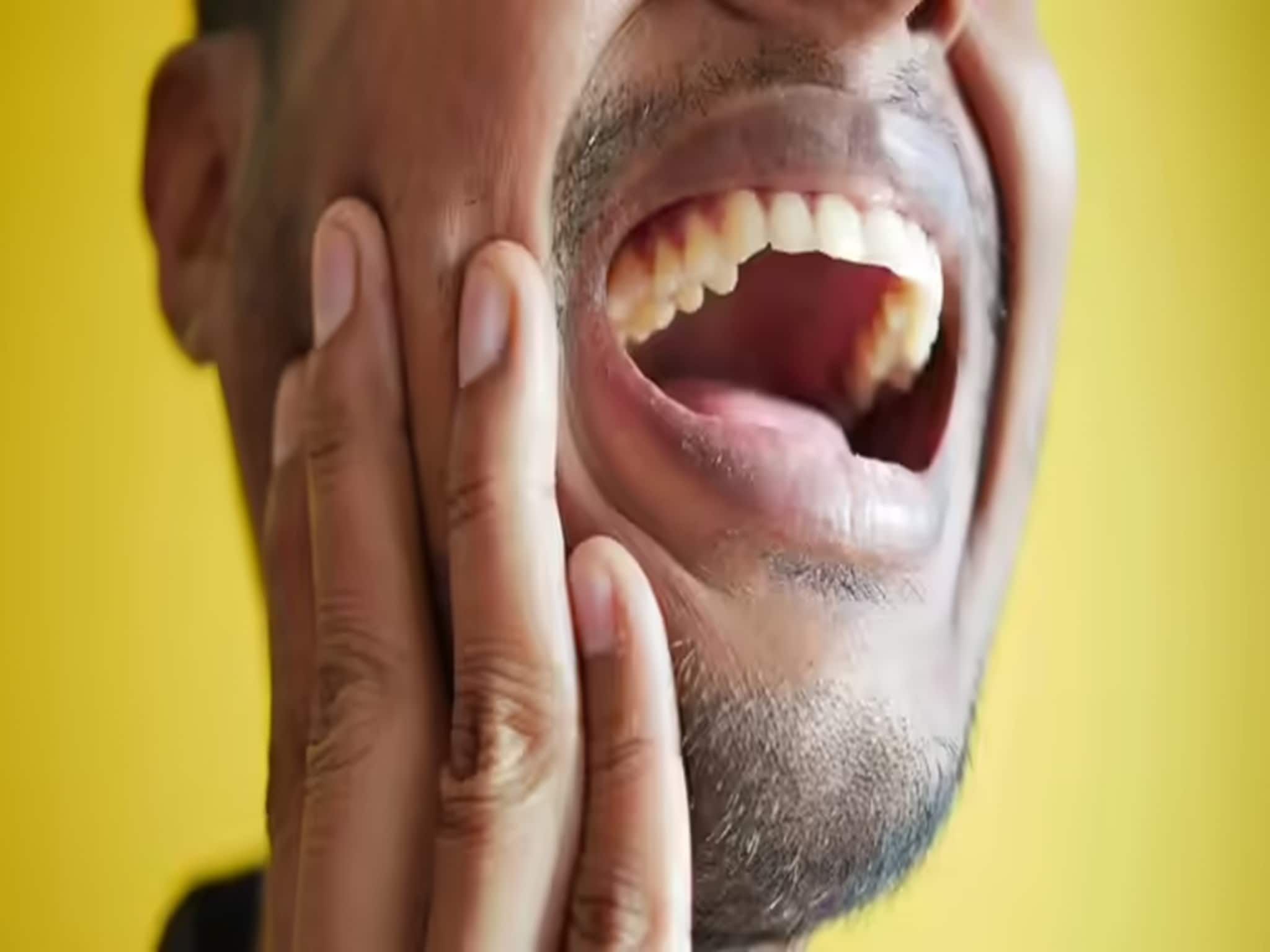 শীতের দিনে আক্কেল দাঁতের ব্যথায় কষ্ট পাচ্ছেন? রইল ডাক্তারের সহজ পরামর্শ, আরাম পাবেন নিমেষে