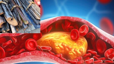 Iron-Rich Taro Leaves: Cheap Superfood for Pregnant Women, Lowers Cholesterol