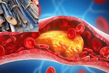 Cholesterol Control Tips: বছরভর খান আয়রনে ভরপুর সস্তার 'এই' শাক! গর্ভবতীদের জন্য দ্বিগুণ উপকারী, শরীর থেকে নিংড়ে নেয় কোলেস্টেরল