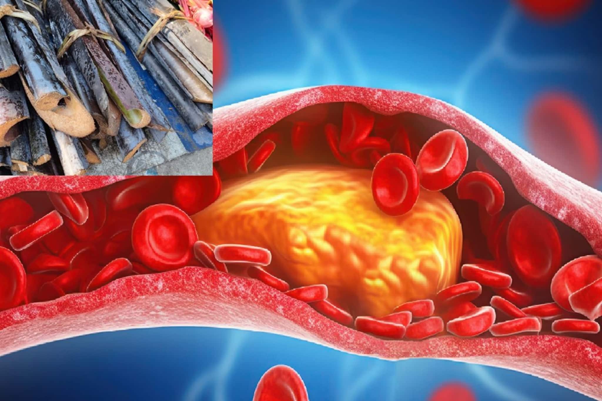 বছরভর খান আয়রনে ভরপুর সস্তার 'এই' শাক!গর্ভবতীদের জন্য দ্বিগুণ উপকারী,নিংড়ে নেয় কোলেস্টেরল বছরভর খান আয়রনে ভরপুর সস্তার 'এই' শাক!গর্ভবতীদের জন্য দ্বিগুণ উপকারী,নিংড়ে নেয় কোলেস্টেরল