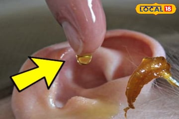 ব্যথা নয়, ঝামেলাও নয়! ঘরোয়া টোটকা মানলেই গলগল করে বেরিয়ে আসবে কানের সমস্ত জমে থাকা ময়লা! ব্যথা নয়, ঝামেলাও নয়! ঘরোয়া টোটকা মানলেই গলগল করে বেরিয়ে আসবে কানের সমস্ত জমে থাকা ময়লা!