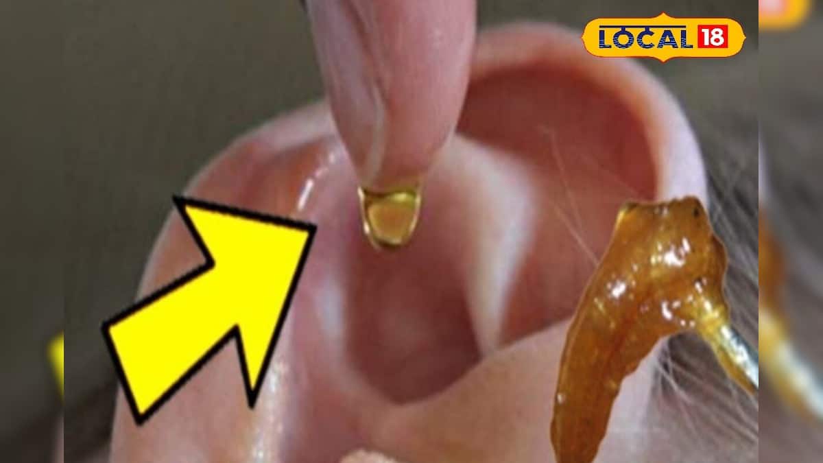 ব্যথা নয়, ঝামেলাও নয়! ঘরোয়া টোটকা মানলেই গলগল করে বেরিয়ে আসবে কানের সমস্ত জমে থাকা ময়লা! ব্যথা নয়, ঝামেলাও নয়! ঘরোয়া টোটকা মানলেই গলগল করে বেরিয়ে আসবে কানের সমস্ত জমে থাকা ময়লা!