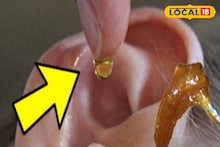 ব্যথা নয়, ঝামেলাও নয়! ঘরোয়া টোটকা মানলেই গলগল করে বেরিয়ে আসবে কানের সমস্ত জমে থাকা ময়লা!