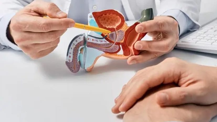 *প্রস্টেট ক্যানসার বিশ্বব্যাপী পুরুষদের মধ্যে সবচেয়ে সাধারণ ক্যানসারগুলির মধ্যে একটি। এই ক্যানসার প্রস্টেট গ্রন্থিকে প্রভাবিত করে, যা পুরুষ প্রজনন ব্যবস্থায় গুরুত্বপূর্ণ ভূমিকা পালন করে। যদি চিকিৎসা না করা হয়, তাহলে এই রোগ জীবন তছনছ করে দিতে পারে। ডাঃ শ্যাম সিং ভিষ্ট, সহযোগী পরিচালক, ক্যানসার কেয়ার, রেডিয়েশন অঙ্কোলজি, মেদান্ত, গুরুগ্রাম, প্রোস্টেট ক্যানসারের লক্ষণ, রোগ নির্ণয়, চিকিৎসা এবং উন্নত চিকিৎসার বিকল্প সম্পর্কে জানিয়েছেন... *প্রস্টেট ক্যানসার বিশ্বব্যাপী পুরুষদের মধ্যে সবচেয়ে সাধারণ ক্যানসারগুলির মধ্যে একটি। এই ক্যানসার প্রস্টেট গ্রন্থিকে প্রভাবিত করে, যা পুরুষ প্রজনন ব্যবস্থায় গুরুত্বপূর্ণ ভূমিকা পালন করে। যদি চিকিৎসা না করা হয়, তাহলে এই রোগ জীবন তছনছ করে দিতে পারে। ডাঃ শ্যাম সিং ভিষ্ট, সহযোগী পরিচালক, ক্যানসার কেয়ার, রেডিয়েশন অঙ্কোলজি, মেদান্ত, গুরুগ্রাম, প্রোস্টেট ক্যানসারের লক্ষণ, রোগ নির্ণয়, চিকিৎসা এবং উন্নত চিকিৎসার বিকল্প সম্পর্কে জানিয়েছেন...