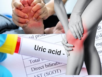 বন্ধ করুন সুস্বাদু ৫ খাবার, পেটে গেলে হুড়মুড়িয়ে বাড়ে ইউরিক অ্যাসিড, হাড়-গিঁটে ব্যথায় কাবু বন্ধ করুন সুস্বাদু ৫ খাবার, পেটে গেলে হুড়মুড়িয়ে বাড়ে ইউরিক অ্যাসিড, হাড়-গিঁটে ব্যথায় কাবু