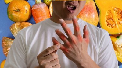 Uric Acid: Stop These Foods to Prevent Joint Pain & Kidney Problems