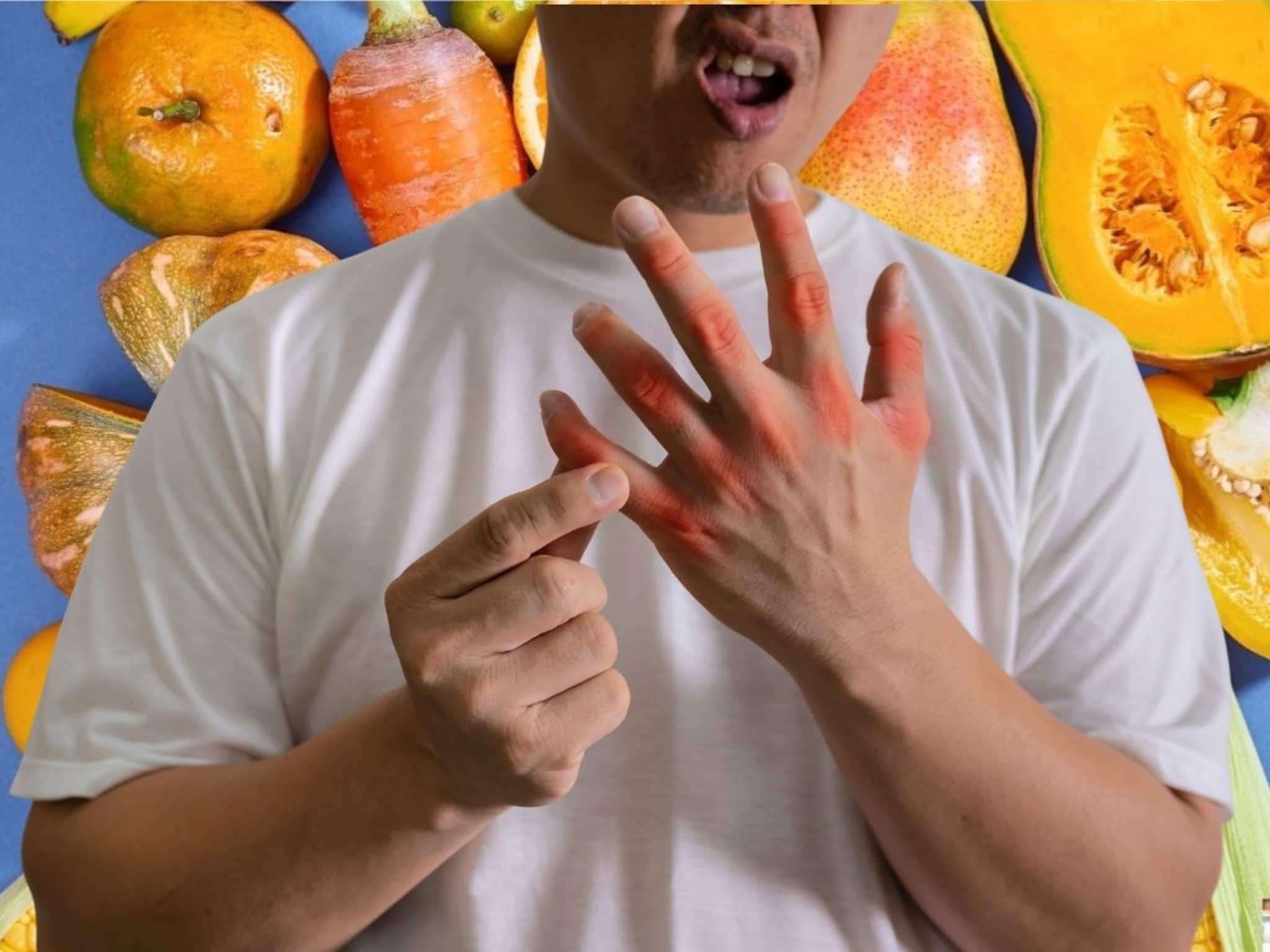 বন্ধ করুন সুস্বাদু ৫ খাবার, পেটে গেলে হুড়মুড়িয়ে বাড়ে ইউরিক অ্যাসিড, হাড়-গিঁটে ব্যথায় কাবু বন্ধ করুন সুস্বাদু ৫ খাবার, পেটে গেলে হুড়মুড়িয়ে বাড়ে ইউরিক অ্যাসিড, হাড়-গিঁটে ব্যথায় কাবু