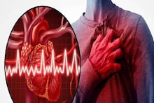 Heart Disease Signs: ত্বকও জানায় হার্ট অ্যাটাক, হার্ট ফেলিওরের লক্ষণ! এই '৫' ধরণের দাগ শরীরে থাকলে সাবধান, আজই চিকিৎসকের কাছে যান