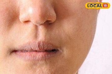 শীতে মুখের ত্বক হয়ে উঠেছে রুক্ষ, হারিয়েছে উজ্জ্বলতা? এই ঘরোয়া ঝলমল হয়ে উঠবে আপনার ত্বক!