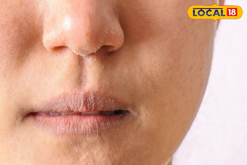 सर्दियों के मौसम में चेहरा दिखने लगा है रुखा, सफ़ेद पन तो घरेलू नुक्से से करें बचाव 