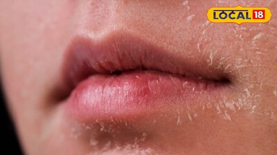 Winter Skin Woes? Revive Your Glow with These Natural Home Remedies!