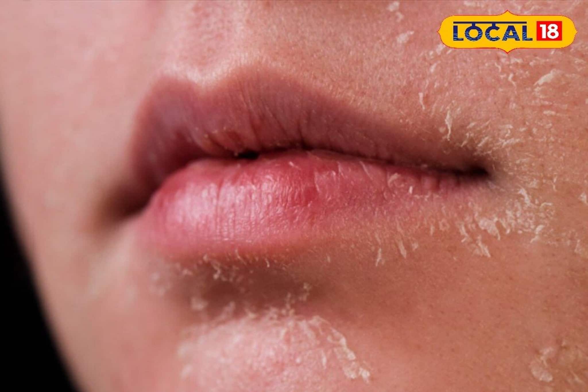 শীতে মুখের ত্বক হয়ে উঠেছে রুক্ষ, হারিয়েছে উজ্জ্বলতা? এই ঘরোয়া ঝলমল হয়ে উঠবে আপনার ত্বক!