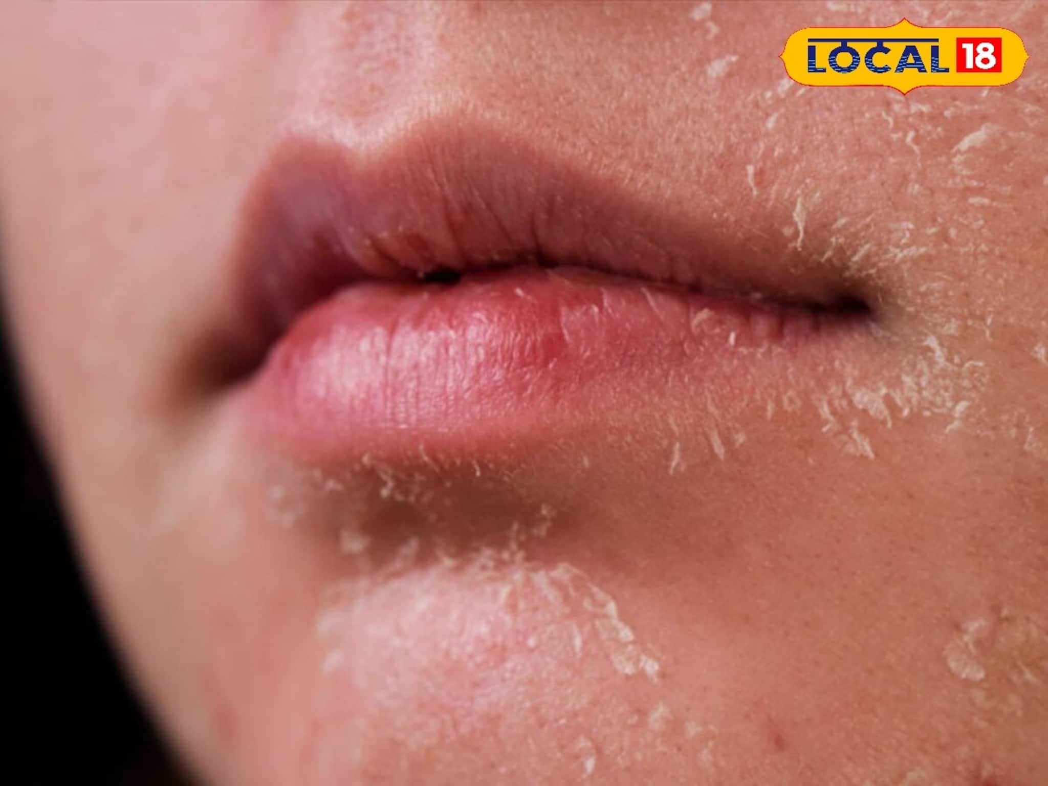 শীতে মুখের ত্বক হয়ে উঠেছে রুক্ষ, হারিয়েছে উজ্জ্বলতা? এই ঘরোয়া ঝলমল হয়ে উঠবে আপনার ত্বক!