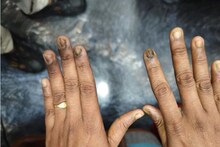 নখ কালচে ও ভঙ্গুর হয়ে যাচ্ছে? শরীরে বাসা বেঁধেছে কোন রোগ? প্রতিরোধই বা কী ভাবে? চিকিৎসকের পরামর্শ জেনে নিন