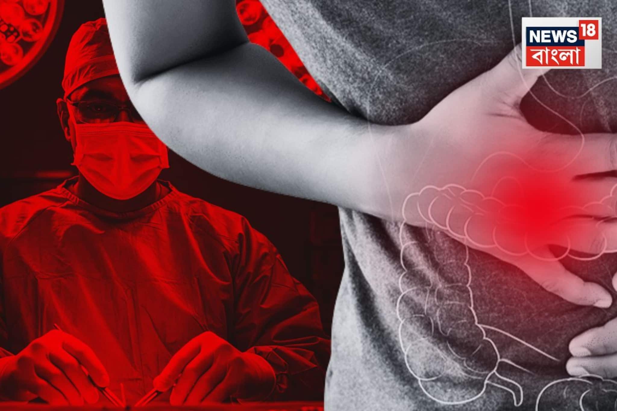 সারাদিন মলত্যাগের অনুভূতি, বহু বছরের ক্রনিক কোষ্ঠকাঠিন্যের সমাধান হবে নিমেষে