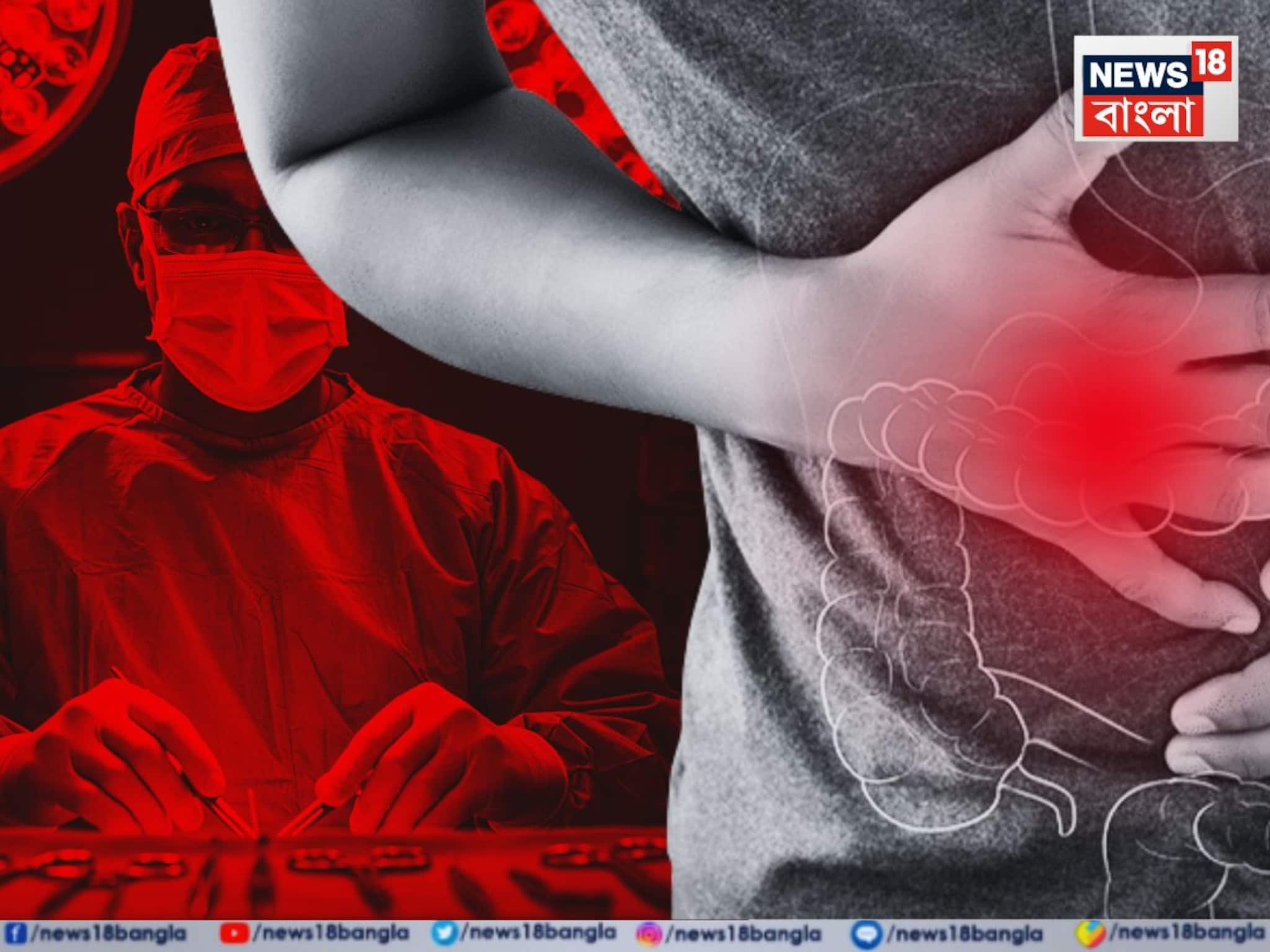 সারাদিন মলত্যাগের অনুভূতি, বহু বছরের ক্রনিক কোষ্ঠকাঠিন্যের সমাধান হবে নিমেষে সারাদিন মলত্যাগের অনুভূতি, বহু বছরের ক্রনিক কোষ্ঠকাঠিন্যের সমাধান হবে নিমেষে