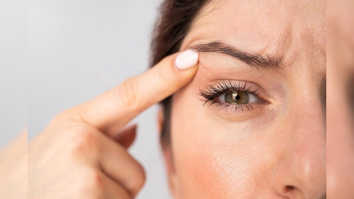 Eye Twitching Problem: আপনার কি মাঝে মাঝেই চোখের পাতা কাঁপে? কুসংস্কার নয়, আপনি হয়তো জটিল রোগে ভুগছেন, রইল ডাক্তারের মত Eye Twitching Problem: আপনার কি মাঝে মাঝেই চোখের পাতা কাঁপে? কুসংস্কার নয়, আপনি হয়তো জটিল রোগে ভুগছেন, রইল ডাক্তারের মত