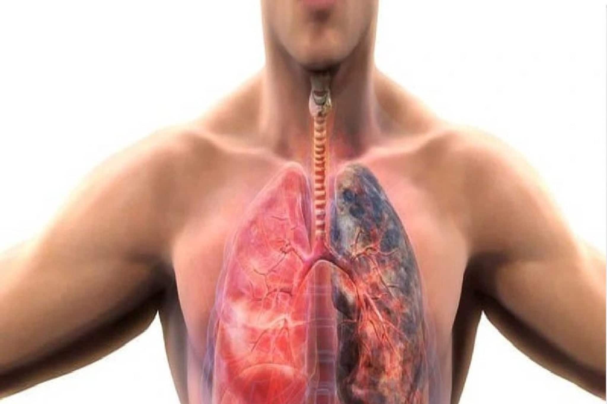 আচমকা পারদ পতনে চরম কষ্ট! ঠান্ডা হাওয়া, দূষণ COPD রোগীদের ফুসফুসের কাজকে কীভাবে বাধা দেয়?