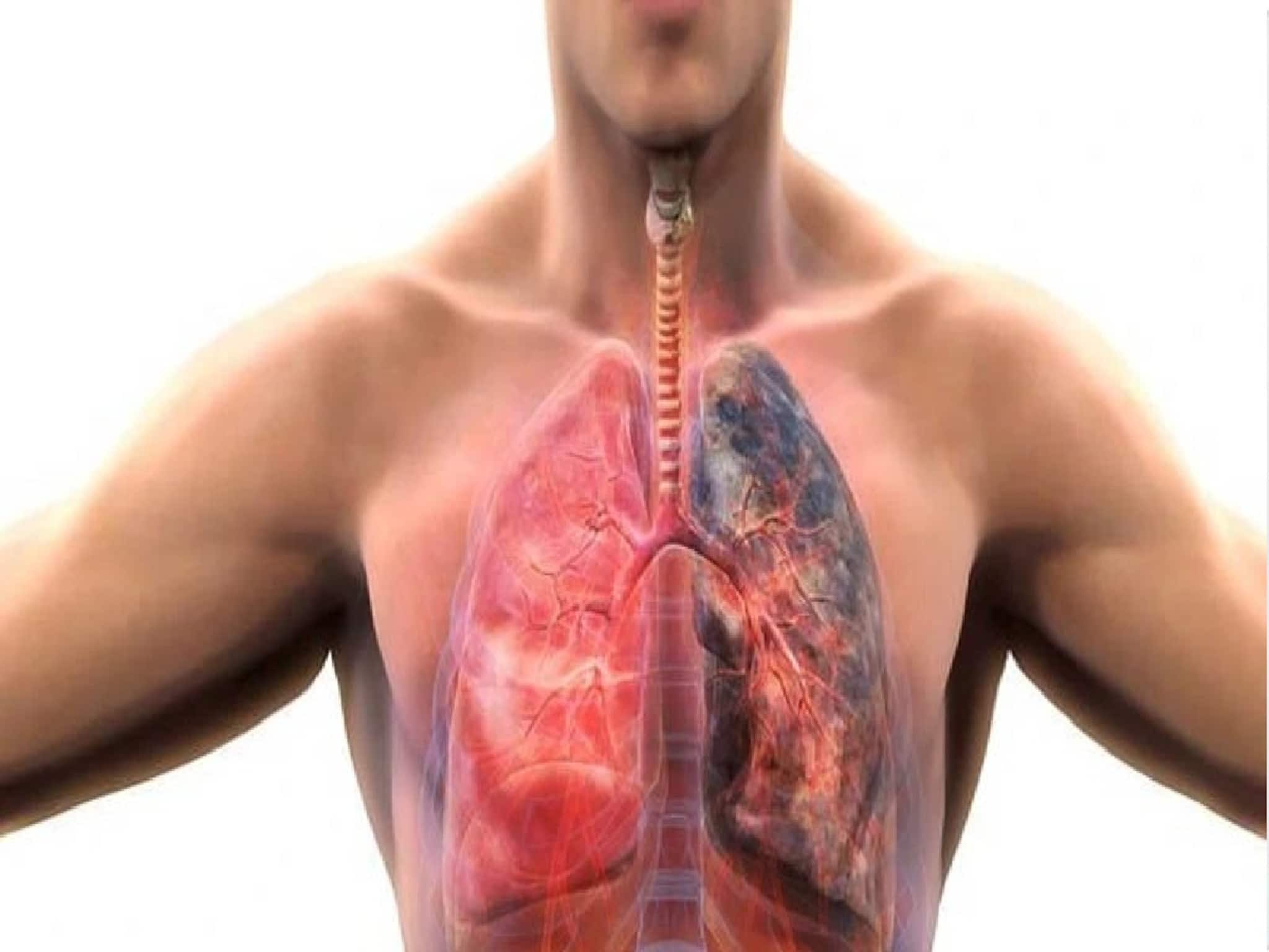 আচমকা পারদ পতনে চরম কষ্ট! ঠান্ডা হাওয়া, দূষণ COPD রোগীদের ফুসফুসের কাজকে কীভাবে বাধা দেয়?