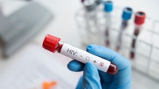 এইচআইভি-র চিকিৎসায় আশার আলো? ছোট্ট গবেষণায় মিলল বড় সম্ভাবনার ইঙ্গিত এইচআইভি-র চিকিৎসায় আশার আলো? ছোট্ট গবেষণায় মিলল বড় সম্ভাবনার ইঙ্গিত