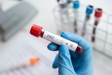 পাকাপাকি বিদায় নেবে HIV? এক ডোজেই কাবু ভাইরাস! ছোট্ট গবেষণায় মিলল বিরাট সমাধান!