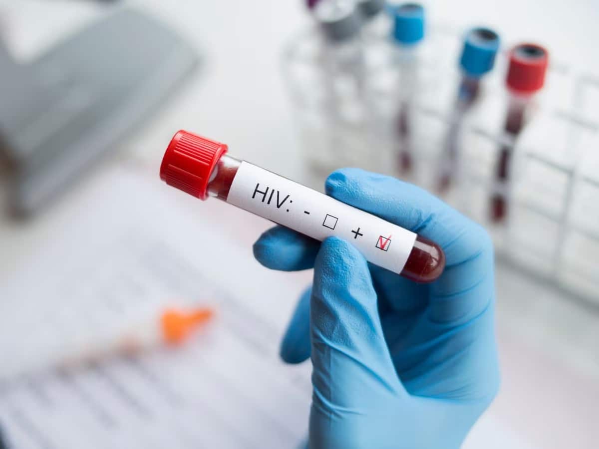 পাকাপাকি বিদায় নেবে HIV? এক ডোজেই কাবু ভাইরাস! ছোট্ট গবেষণায় মিলল বিরাট সমাধান! 