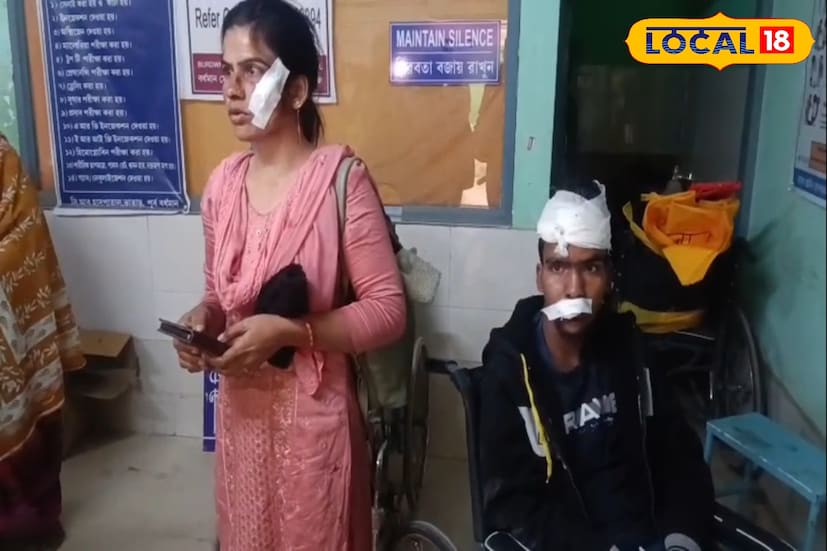 *বর্ধমান-কাটোয়াগামী বাসের চালক বলেন, বর্ধমান থেকে কাটোয়া যাচ্ছিলাম উল্টোদিক থেকে আসা বর্ধমানগামী বাসটির সামনে একটি টোটো ছিল। টোটো থেকে বাঁচাতে গিয়ে বাসটি এসে ধাক্কা মারে। টোটোর জন্যই দুর্ঘটনা ঘটে যায়।