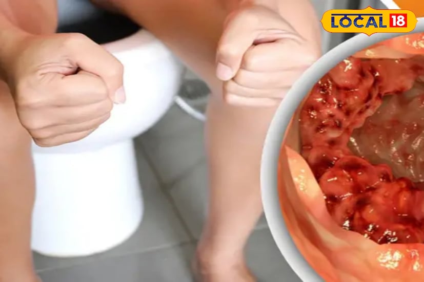 *মুর্শিদাবাদের স্বনামধন্য চিকিৎসক ডাঃ দেবাশিস মণ্ডল জানিয়েছেন, শীতে শরীরের ভেতরের তাপমাত্রা কমে যায়। এই কারণে অন্ত্রে রক্ত চলাচল কমে। হজমের প্রক্রিয়া ধীর হয়ে যায়। অন্ত্রের স্বাভাবিক নড়াচড়া বা পেরিস্টালসিস গতি হারায়।