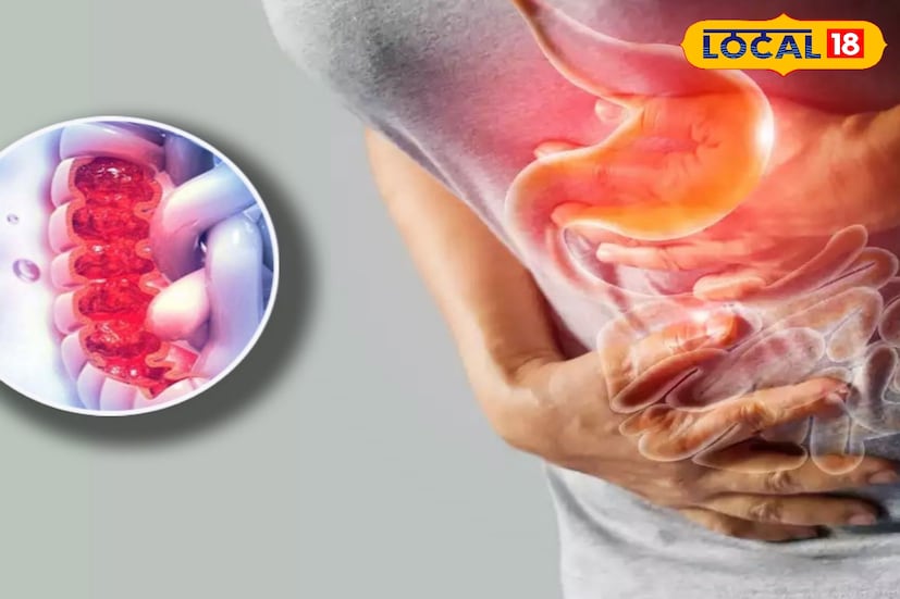 *কোষ্ঠকাঠিন্যের মূল কারণ হল পেটের পেশির দুর্বলতা। কারও যদি পেটের পেশি সবল হয়, তাহলে পেরিস্টালসিস স্বাভাবিক ভাবেই তার কাজকর্ম করতে থাকে। সেক্ষেত্রে কোনও সমস্যা হয় না।