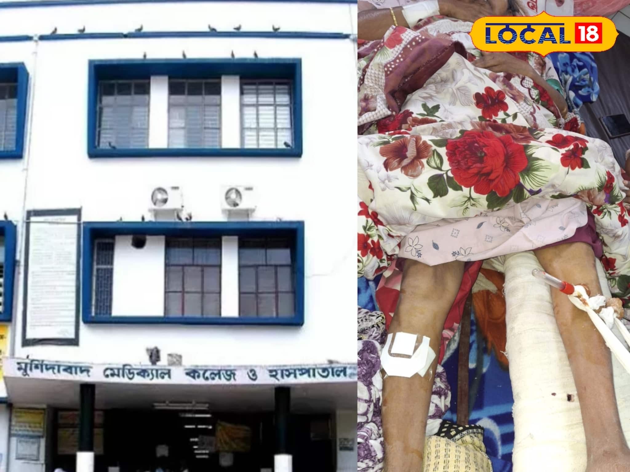 ভেঙেছে বাঁ পা, অস্ত্রোপচার হল ডান পায়ে,মুর্শিদাবাদের হাসপাতালের বিরুদ্ধে বড় অভিযোগ