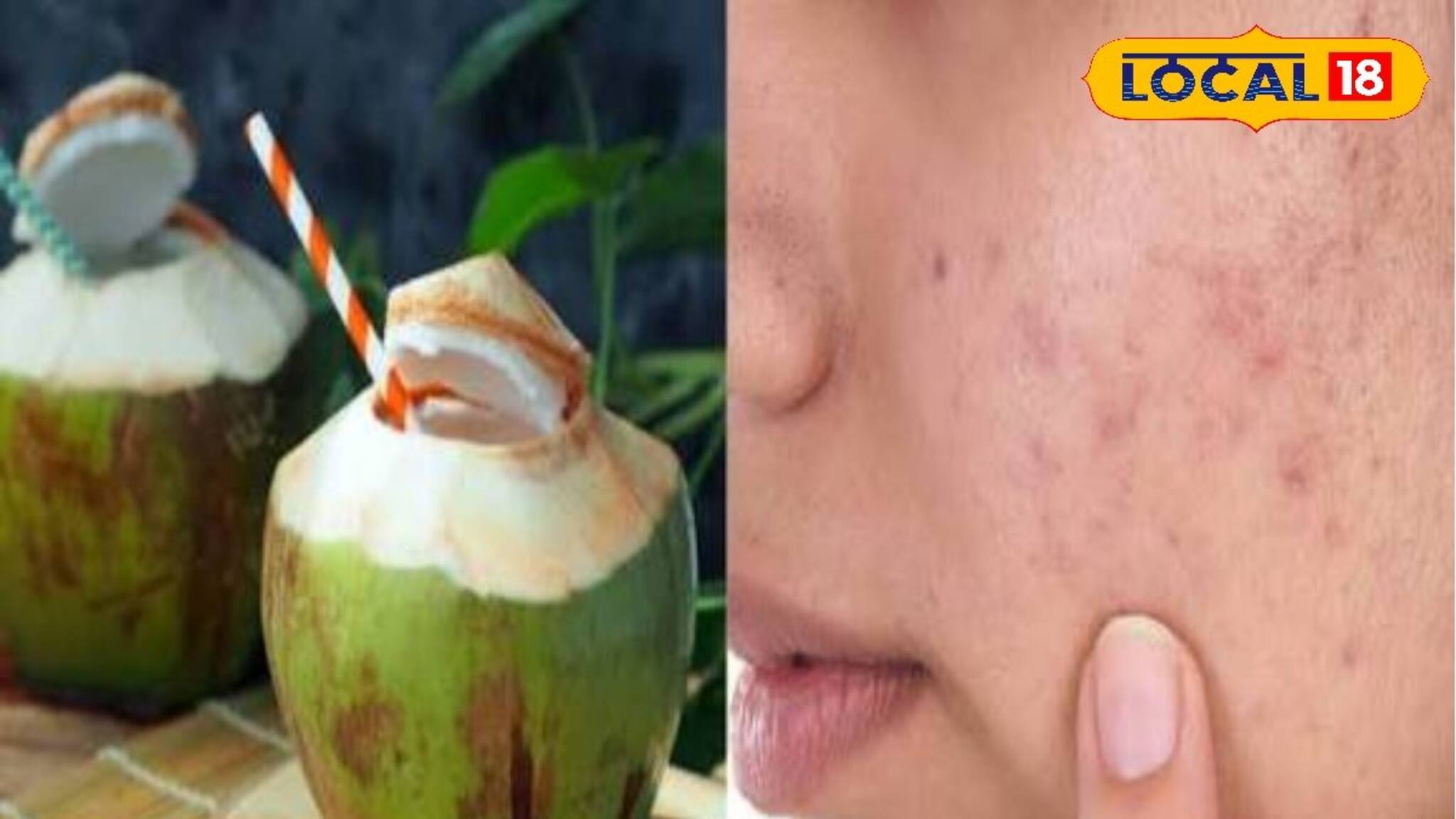 শুধু গরমেই নয় শীতেও খেতে হবে ডাব! এই সময় খেলে কখনও শুষ্ক হবে না ত্বক