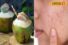 Daab Health Benefits: শুধু গরমেই নয় শীতেও খেতে হবে ডাব! এই সময় খেলে কখনও শুষ্ক হবে না ত্বক