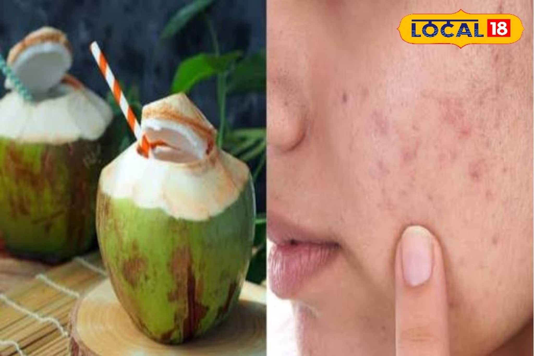 শুধু গরমেই নয় শীতেও খেতে হবে ডাব! এই সময় খেলে কখনও শুষ্ক হবে না ত্বক