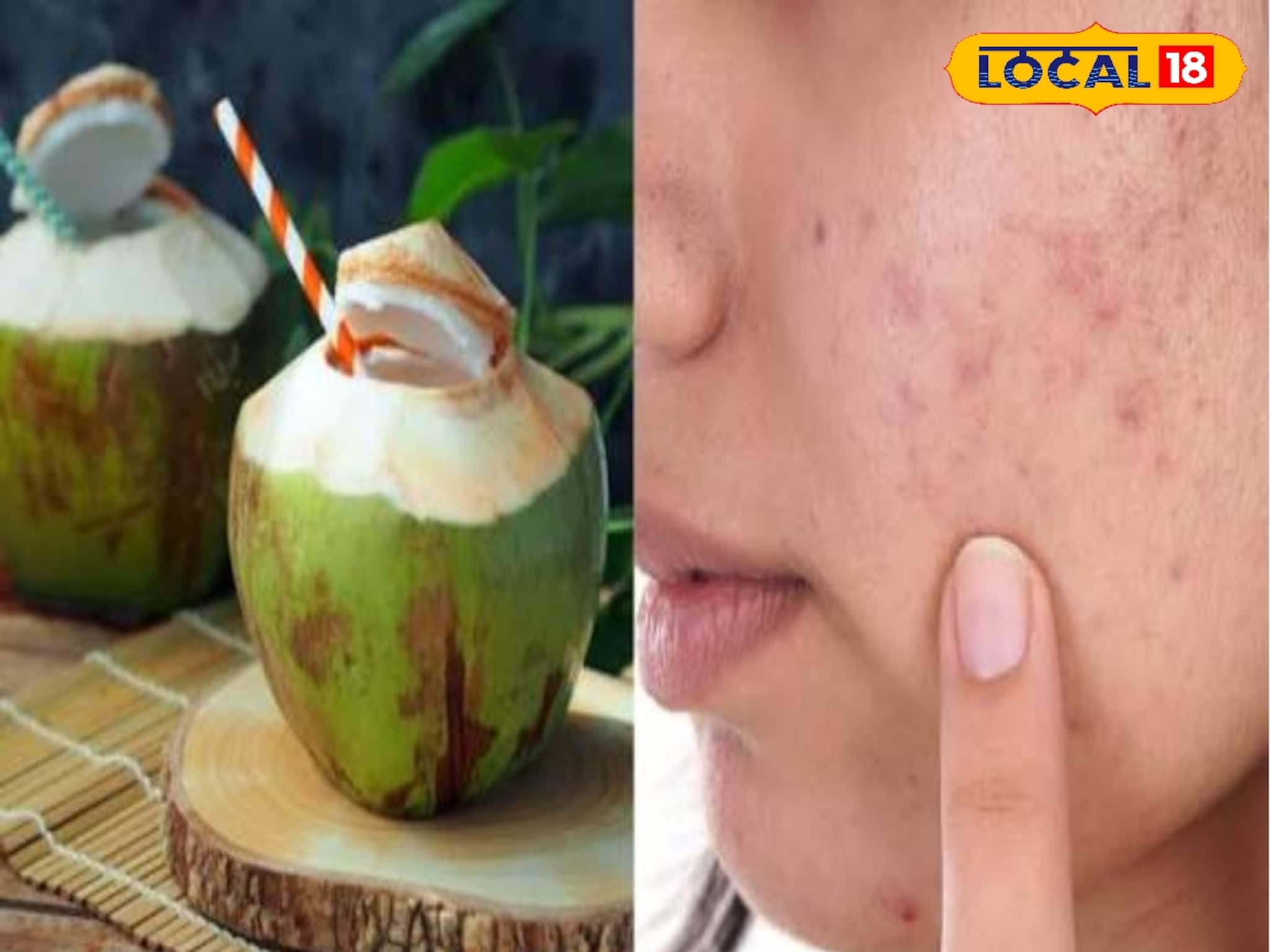 শুধু গরমেই নয় শীতেও খেতে হবে ডাব! এই সময় খেলে কখনও শুষ্ক হবে না ত্বক