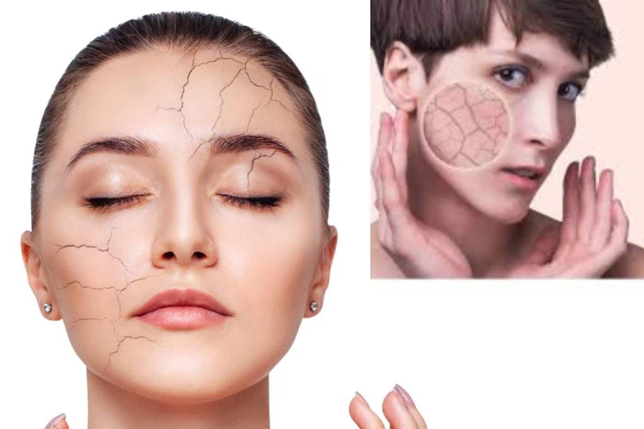 দামি ক্রিম-ময়েশ্চারাইজার লাগবে না! অ্যালোভেরা-নারকেল তেলে মোলায়েম ত্বক! সারবে হাত পা ফাটা!