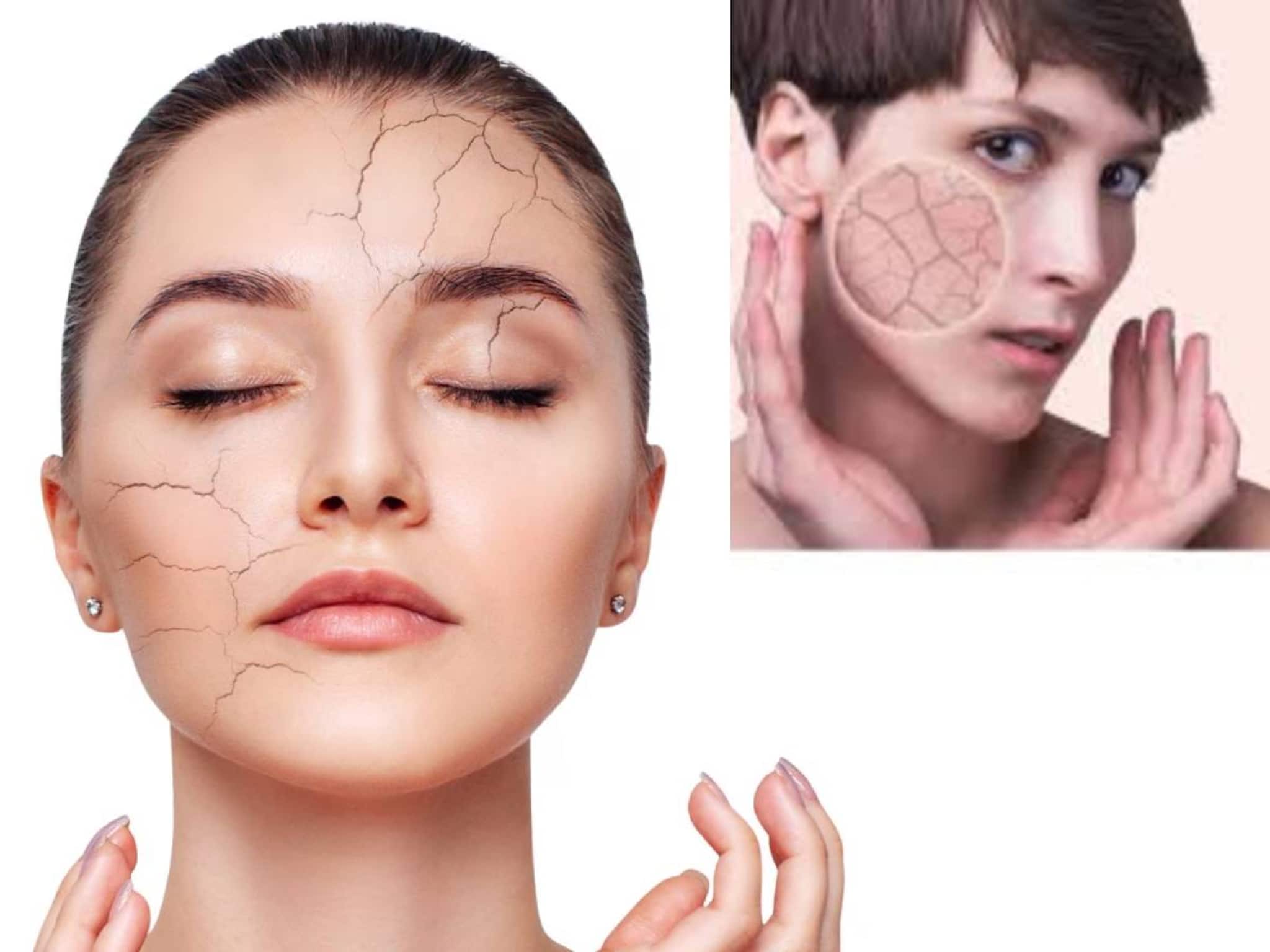 Dry Skin Remedies: দামি ক্রিম-ময়েশ্চারাইজার কিনে টাকা নষ্ট আর নয়! অ্যালোভেরা আর নারকেল তেলেই ননীর মতো মোলায়েম ত্বক! সারবে হাত পায়ের ফুটিফাটা চামড়া!