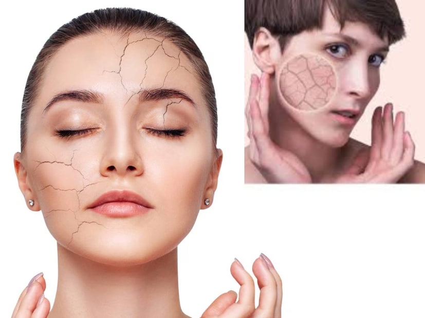 শীতকালে, ঠান্ডা বাতাস ত্বক দ্রুত শুষ্ক করে দিতে পারে। মুখ, হাত এবং পা প্রায়ই রুক্ষ হয়ে যায়। এর ফলে লোকেরা দামি ময়শ্চারাইজার কিনতে বাধ্য হয়, কিন্তু সেগুলো সবসময় ইতিবাচক ফলাফল দেয় না। শীতকালে, ঠান্ডা বাতাস ত্বক দ্রুত শুষ্ক করে দিতে পারে। মুখ, হাত এবং পা প্রায়ই রুক্ষ হয়ে যায়। এর ফলে লোকেরা দামি ময়শ্চারাইজার কিনতে বাধ্য হয়, কিন্তু সেগুলো সবসময় ইতিবাচক ফলাফল দেয় না।