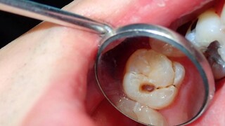 নিমের দাঁতনের সবচেয়ে গুরুত্বপূর্ণ উপকারিতা হল এটি শরীরের কফ দোষের ভারসাম্য বজায় রাখে