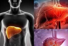 Liver Caring Tips: শীতে দেদার ভূরিভোজের পরও লিভার থাকবে বিষাক্ত জিনিস মুক্ত! আজই বাদ দিন চিনি, ট্রান্স ফ্যাট...মানুন সহজ ৪ টিপস