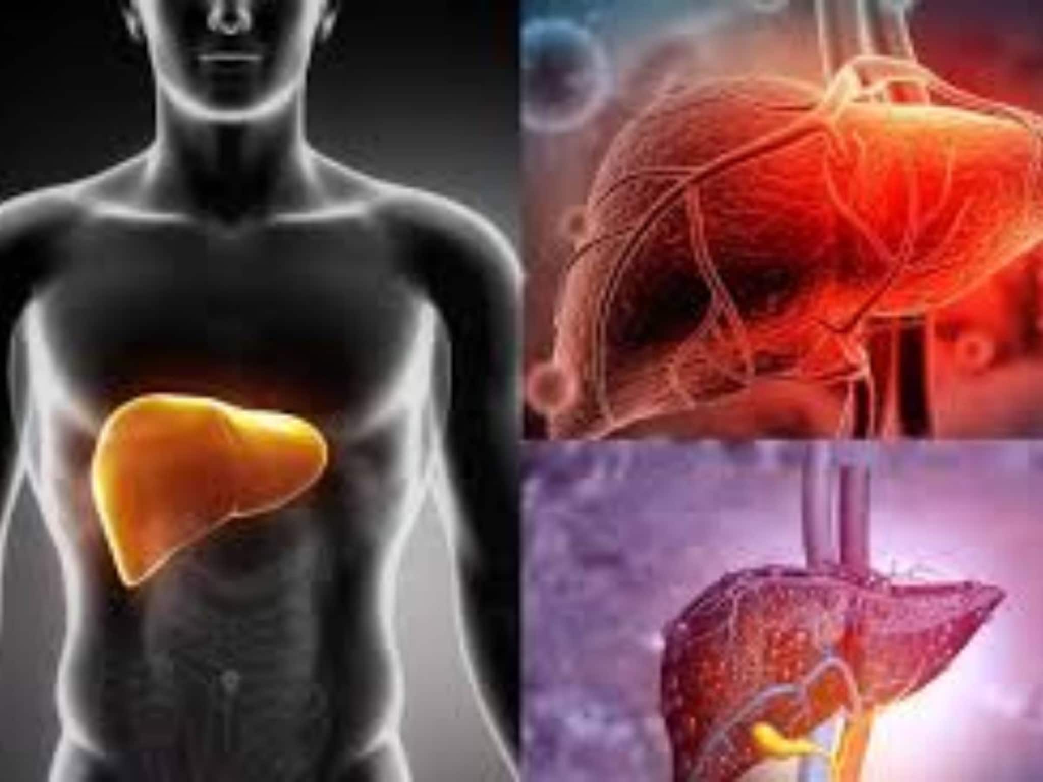 শীতে দেদার ভূরিভোজেও লিভার বিষাক্ত জিনিস মুক্ত! বাদ দিন চিনি, ট্রান্স ফ্যাট...গোল্ডেন রুলস