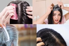 Dandruff & White Hair: টক দইয়ের সঙ্গে এই মশলা জাস্ট ১ চামচ! মাথায় মাখলেই উধাও খুশকি! বন্ধ চুল পাকা!